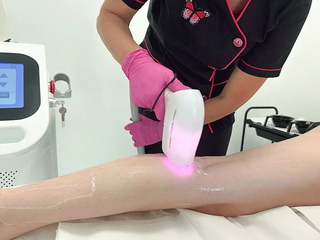 Epilare definitiva cu triplu laser alexandrite Brasov Coresi